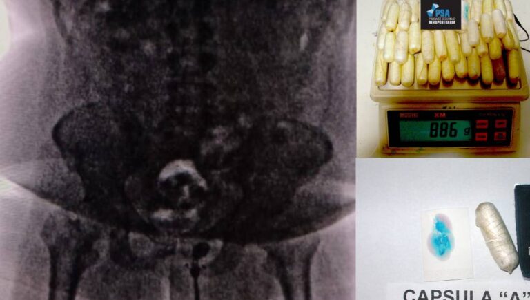 Tenía 90 cápsulas de cocaína en el estómago, iba a viajar a Perú, cayó en Ezeiza