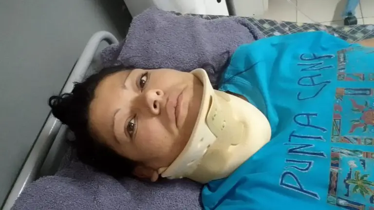 Cuida autos en el centro, sufrió graves heridas al ser embestida por un caballo en Colinas